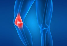 Injuries to Joints