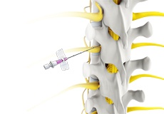 Non-Operative Treatments for Lower Back Injuries